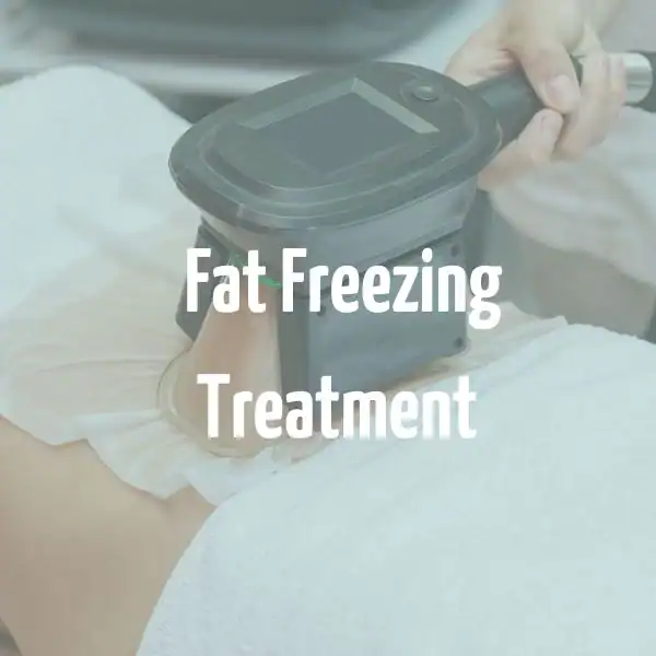 fat freezing treatment Guildford