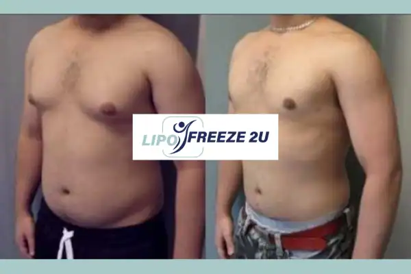 How Long Does It Take to See Results Guildford?
