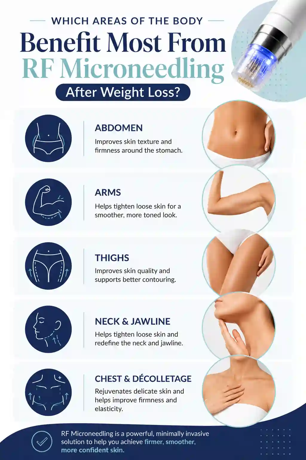 Which Areas of the Body Benefit Most From RF Microneedling After Weight Loss Guildford